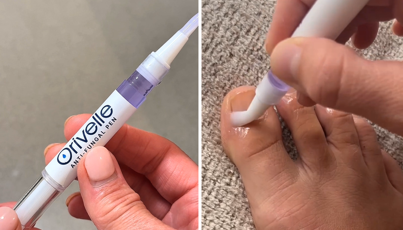 Close-up of the Orivelle pen and its brush tip on a toenail